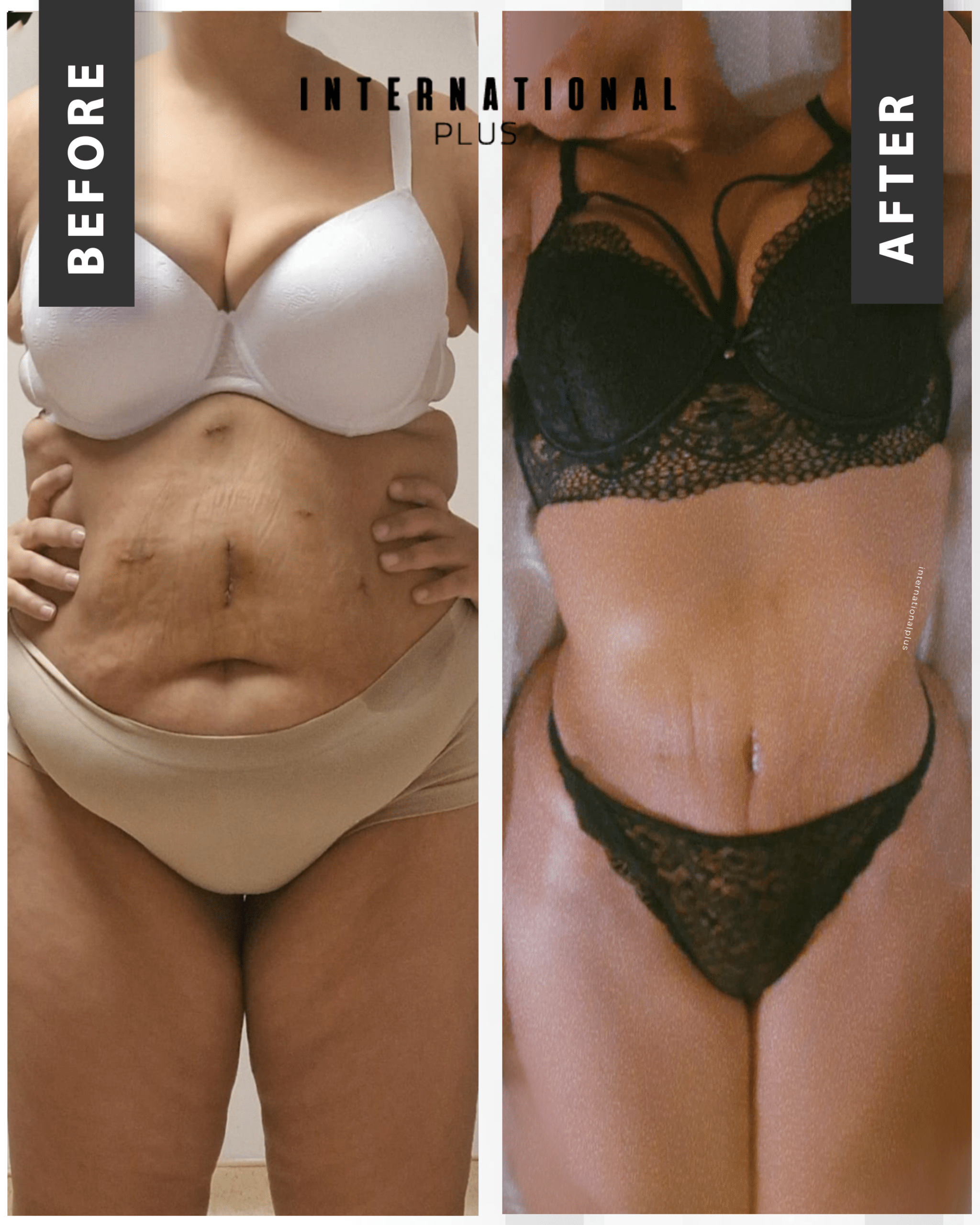 Body Procedures