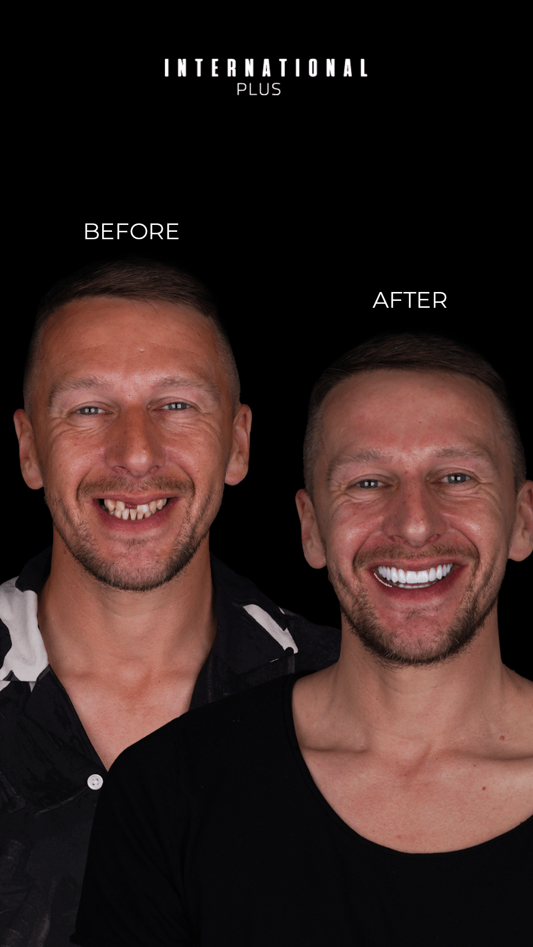 Dental Treatments