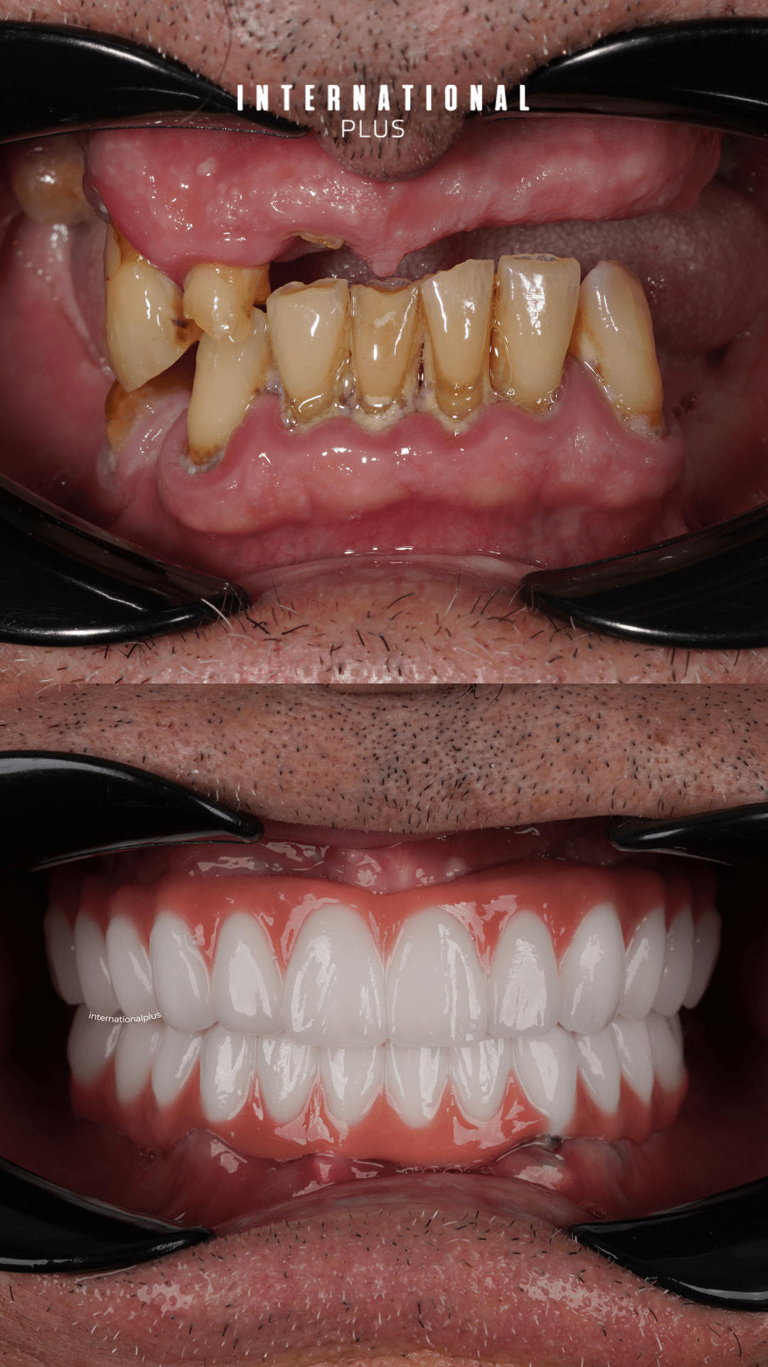 Dental Treatments