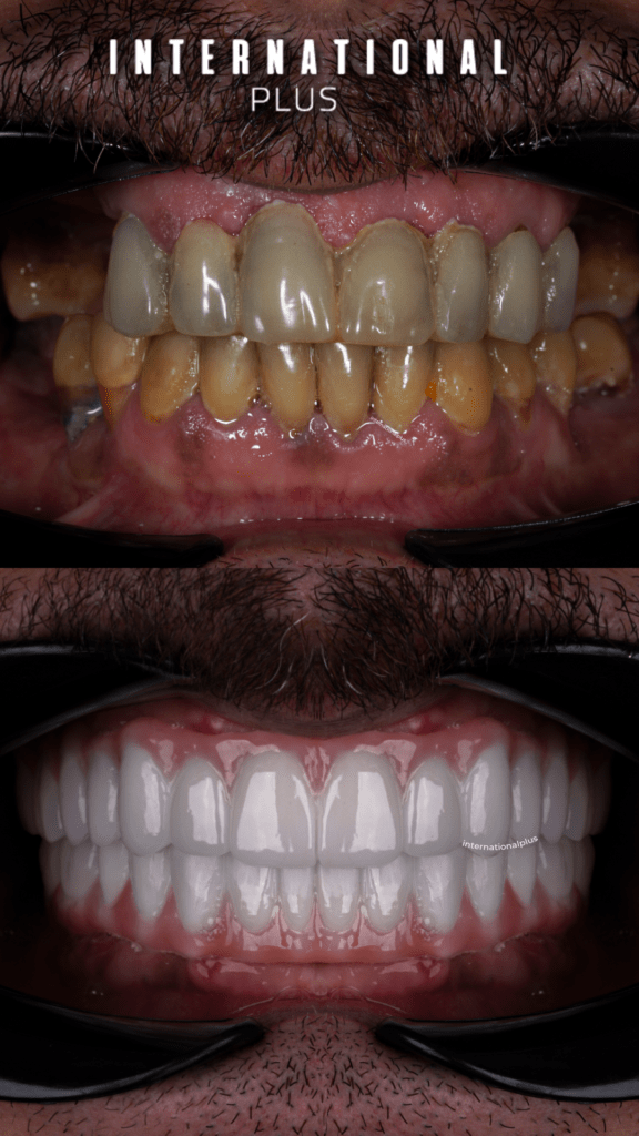 dental4