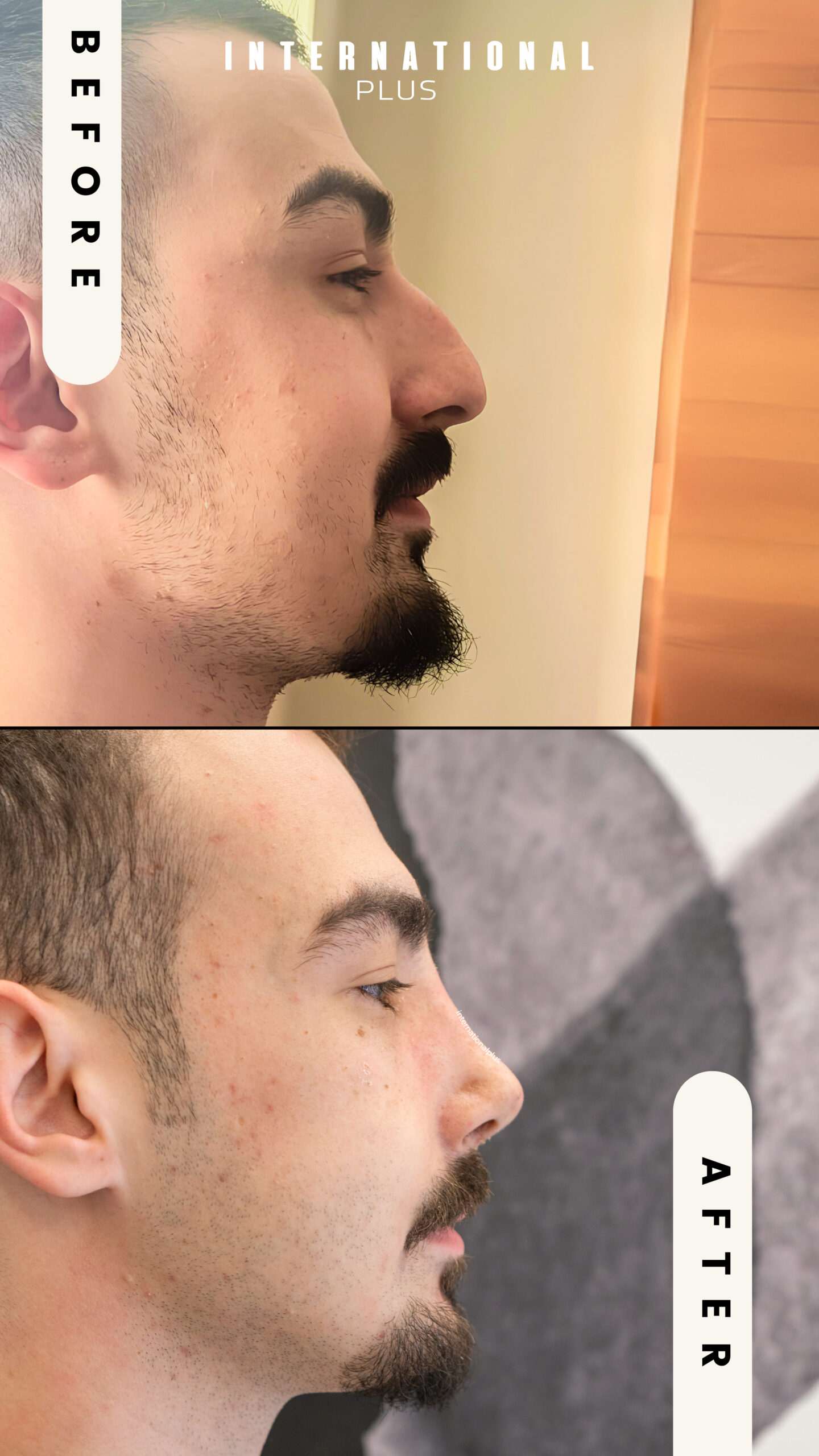Plastic Surgery